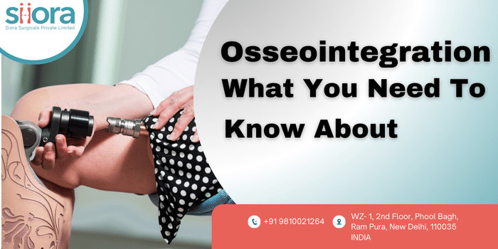 Osseointegration – What You Need to Know&nbsp;About