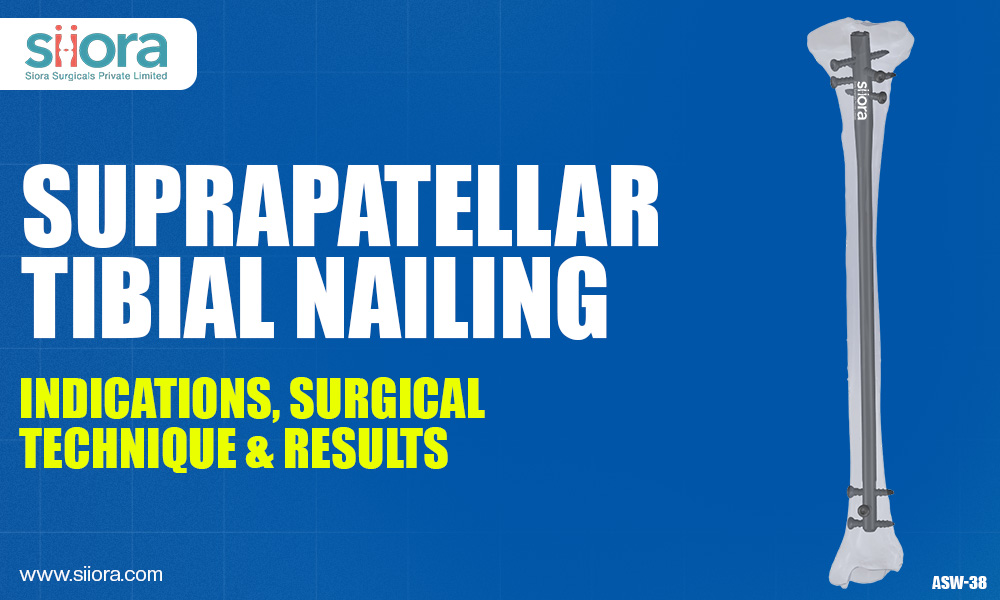 Suprapatellar Tibial Nailing